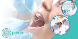 teeth checkup