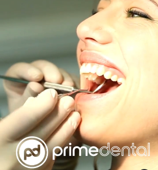 Cost of Full Mouth Dental Implants