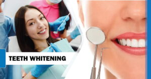 Teeth Whitening