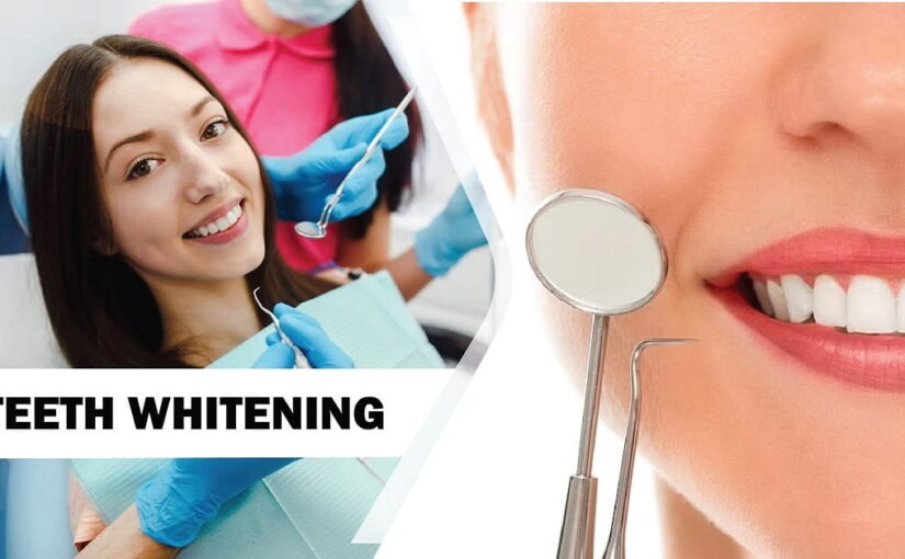 Teeth Whitening