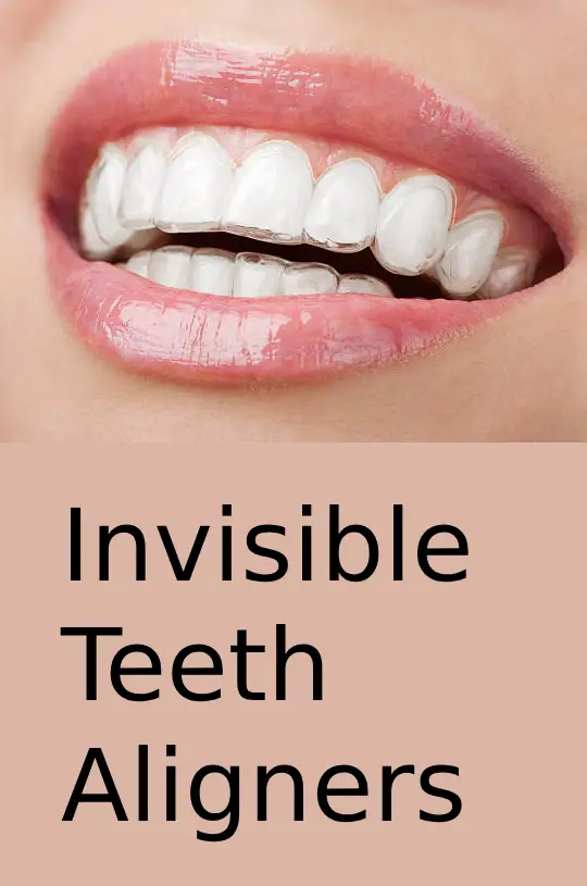 invisible teeth aligner