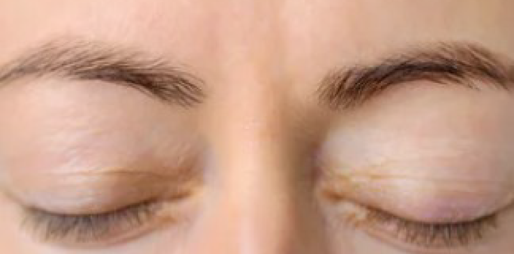 prime dental aestetics eyes