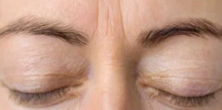 prime dental aestetics eyes